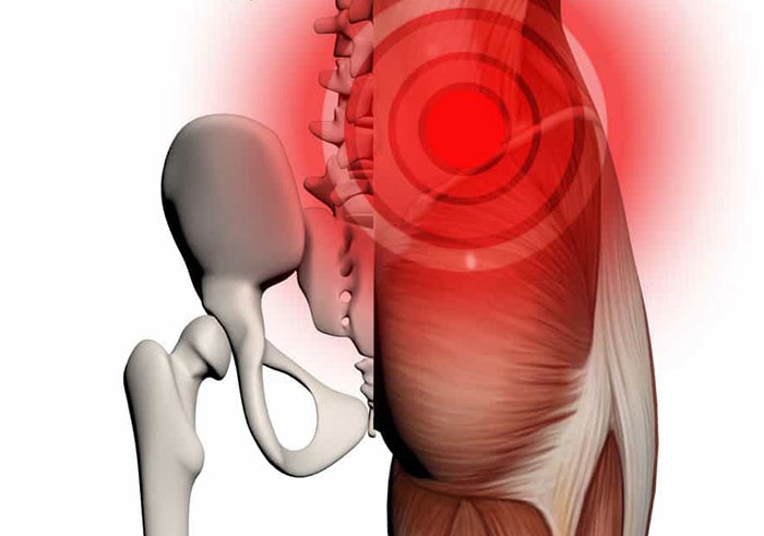 грушевидная мышца как снять спазм